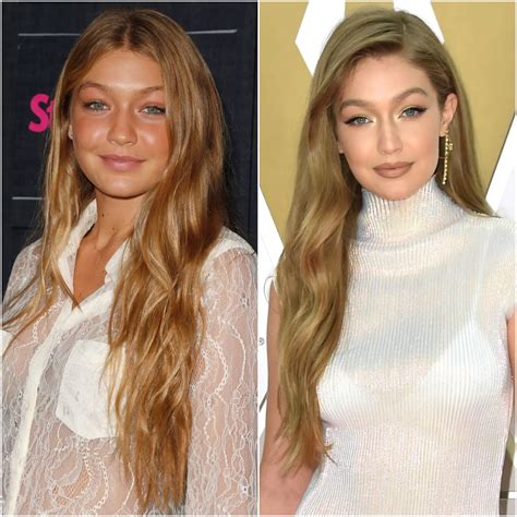 gigi hadid plastic surgery|Gigi Hadid Addresses Plastic Surgery Rumors After Years